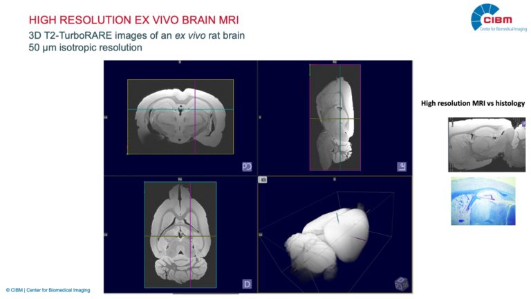 High_Res_exvivo_MRI