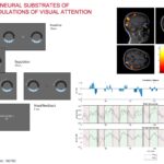 EDEA - Neurofeedback of Visual Attention