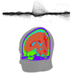 EEG-HUG-UNIGE