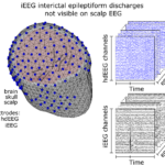 EEG-HUG-UNIGE