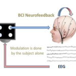 EEG-HUG-UNIGE