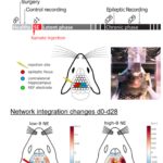 EEG-HUG-UNIGE