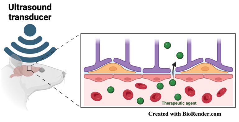 Focused ultrasound to improve therapeutic and radioligand entry into the brain in preclinical models