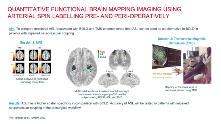 GAZEL_Quantitative fMRI