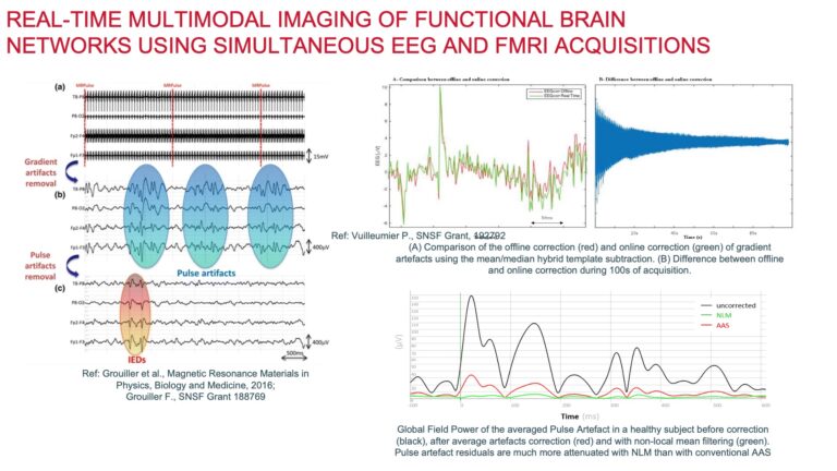QUIRRELL - Real Time EEG-fMRI