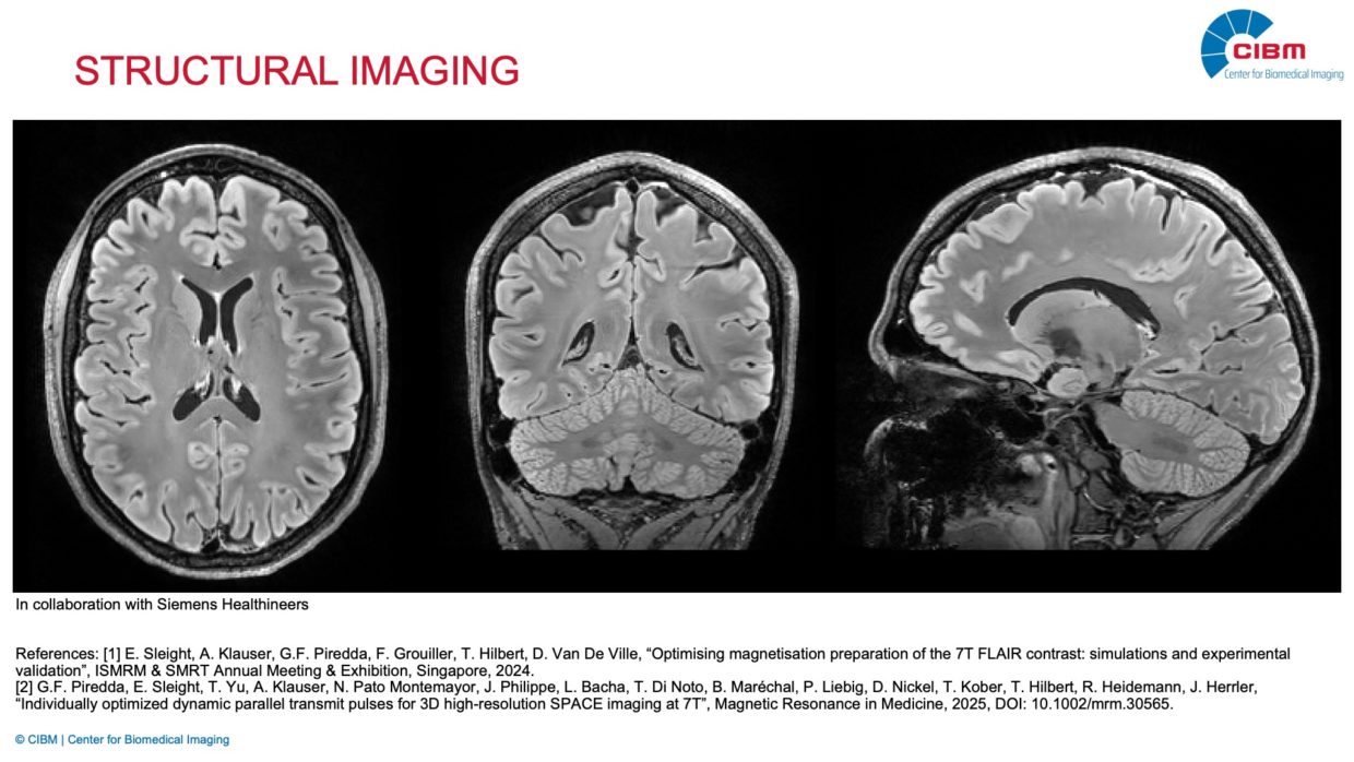 Structral Mri Background MR Imaging Technology - CIBM | Center for Biomedical Imaging