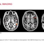 MRI EPFL