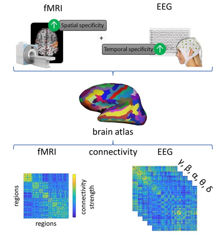 eeg imaging